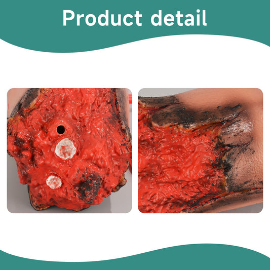 MedEduQuest stop-the-bleed kit worn on severed-arm mannequin enables wearable trauma training.