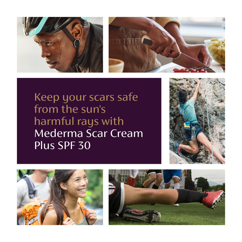 Mederma Scar Cream Plus SPF 30 texture on skin before absorption