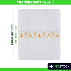 Medstock Transparent Island Dressing wound-pad closeup highlighting breathable layer