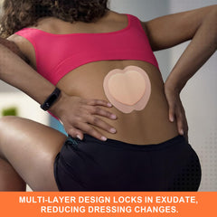 MedVance bordered foam dressing suitable for multiple wound types and uses.