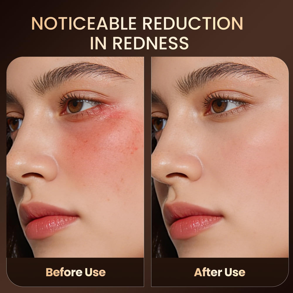MEMTIM mask enables hands-free, at-home treatment while you unwind.