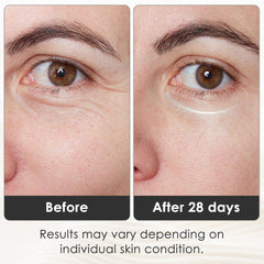 mhpoycd eye mask worn on face showing soft silicone fit for comfort