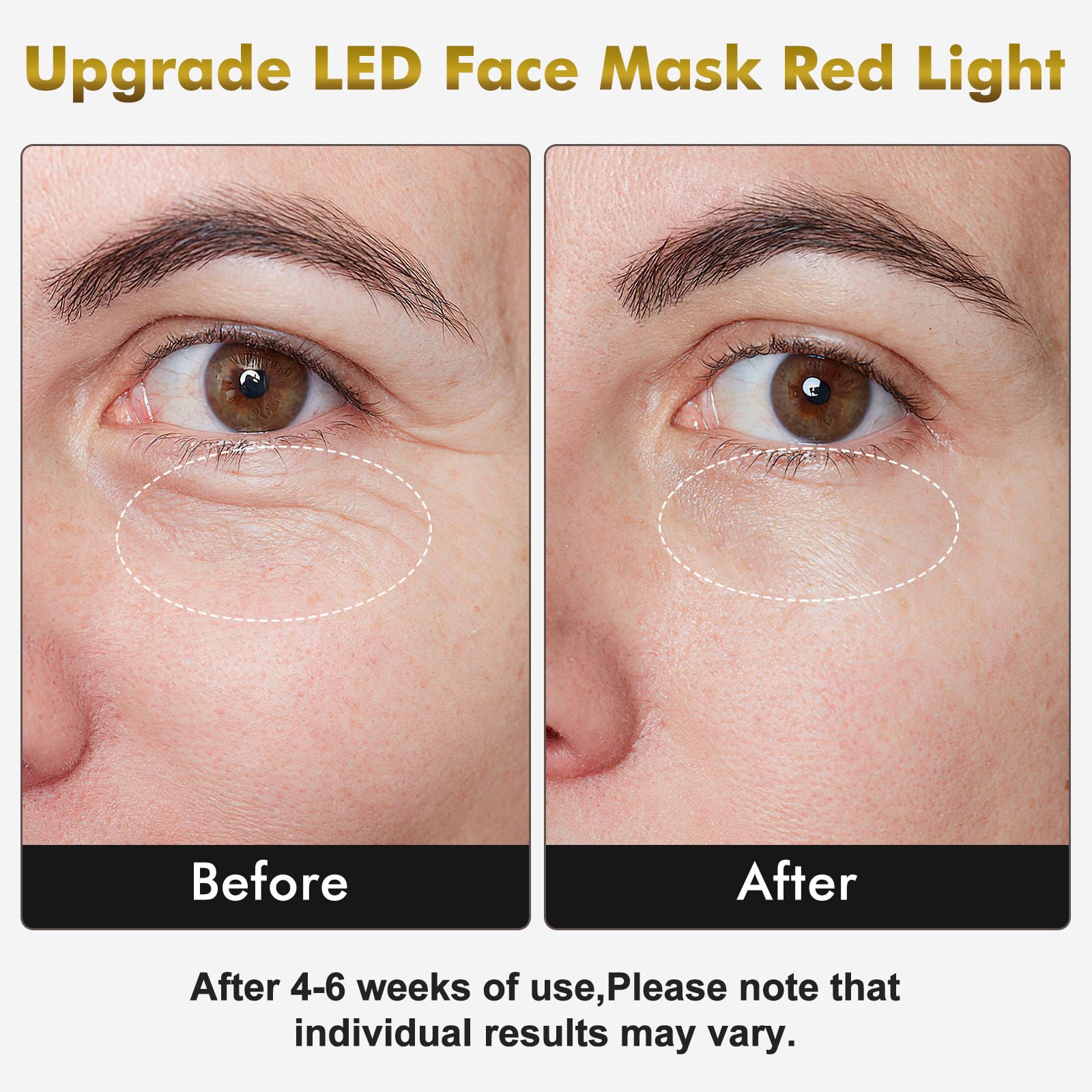 neck mask with 99 LEDs shown side view for synchronized facial-neck treatment