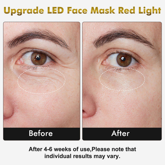 neck mask with 99 LEDs shown side view for synchronized facial-neck treatment