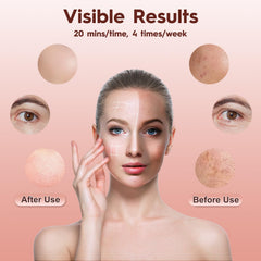 MLriyl soft silicone face mask offering gentle contact for all skin types