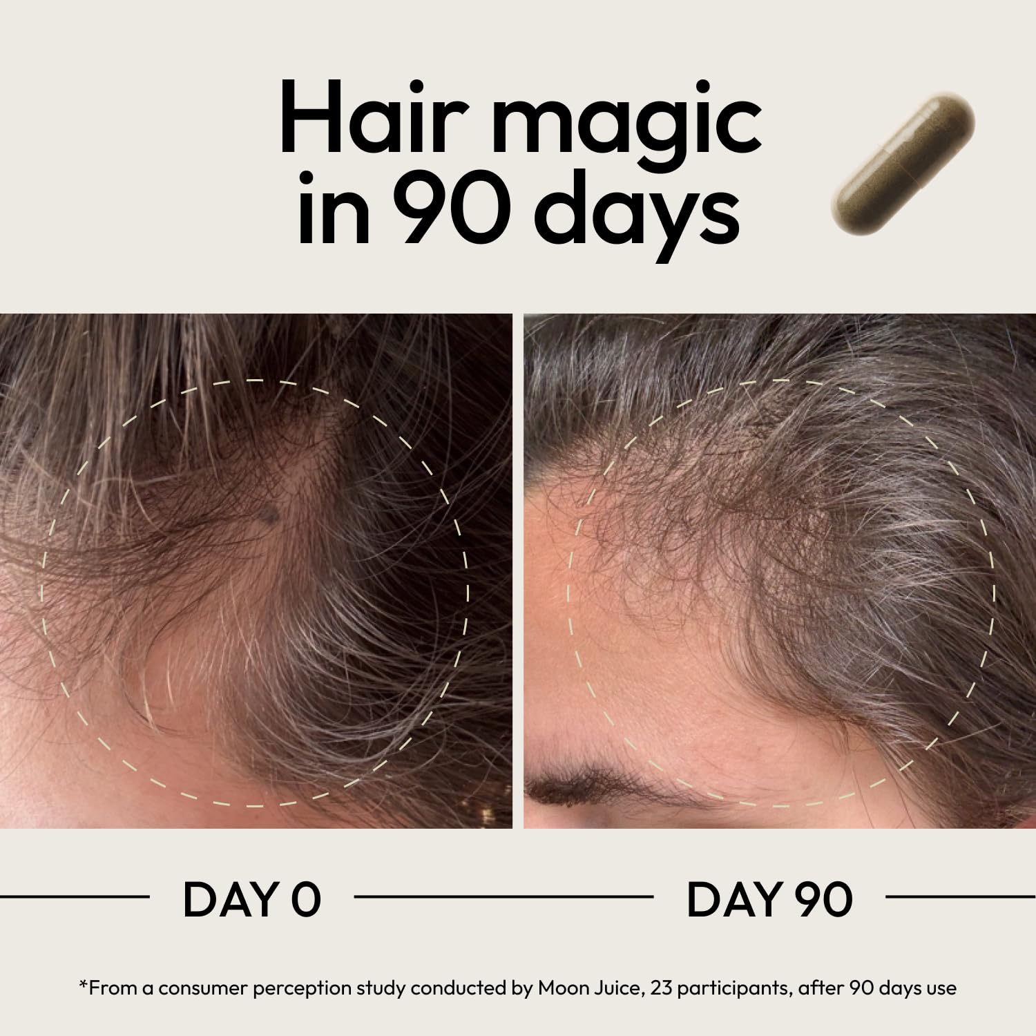 Moon Juice SuperHair ashwagandha blend imagery for stress support