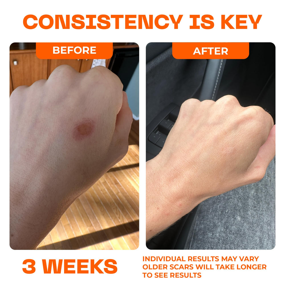 Motivo Scar Care forms a clear, quick-drying film over the scar.