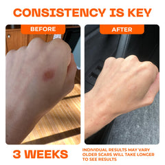 Motivo Scar Care forms a clear, quick-drying film over the scar.
