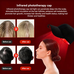 MUMAIS red light cap built-in battery enables cordless use.