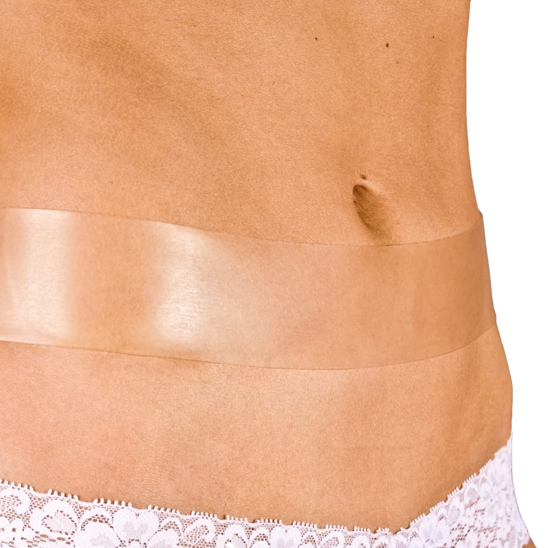 MyNewGel Advanced tape for keloids delivers a smooth scar appearance.
