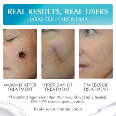 Vitamin E ingredient label highlights added nourishment for skin-friendly scar care