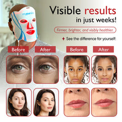 mypurskin Pro Grade Mask eye shades secure a comfortable fit.