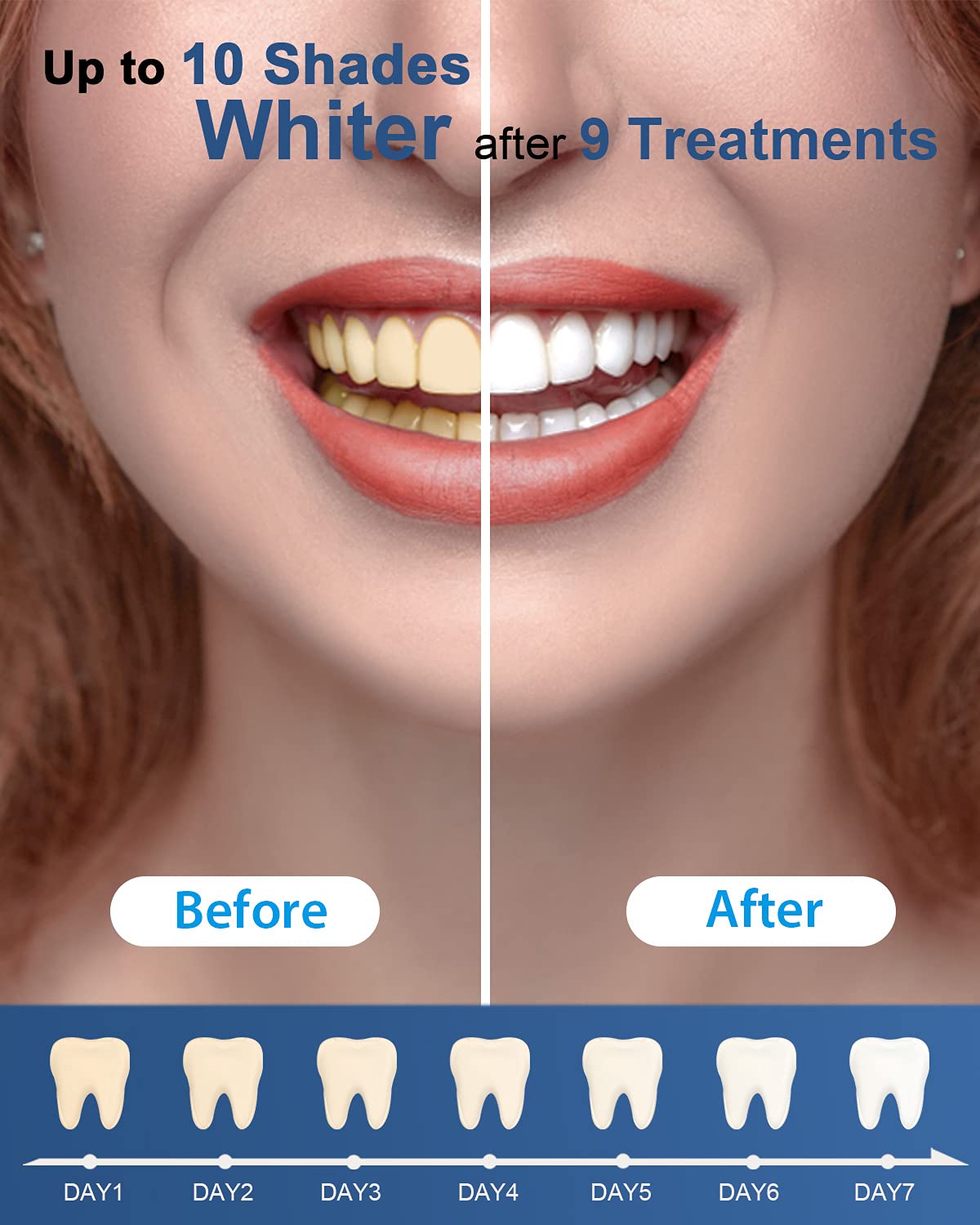 MySmile gel helps lift stains from coffee, wine, and tea.