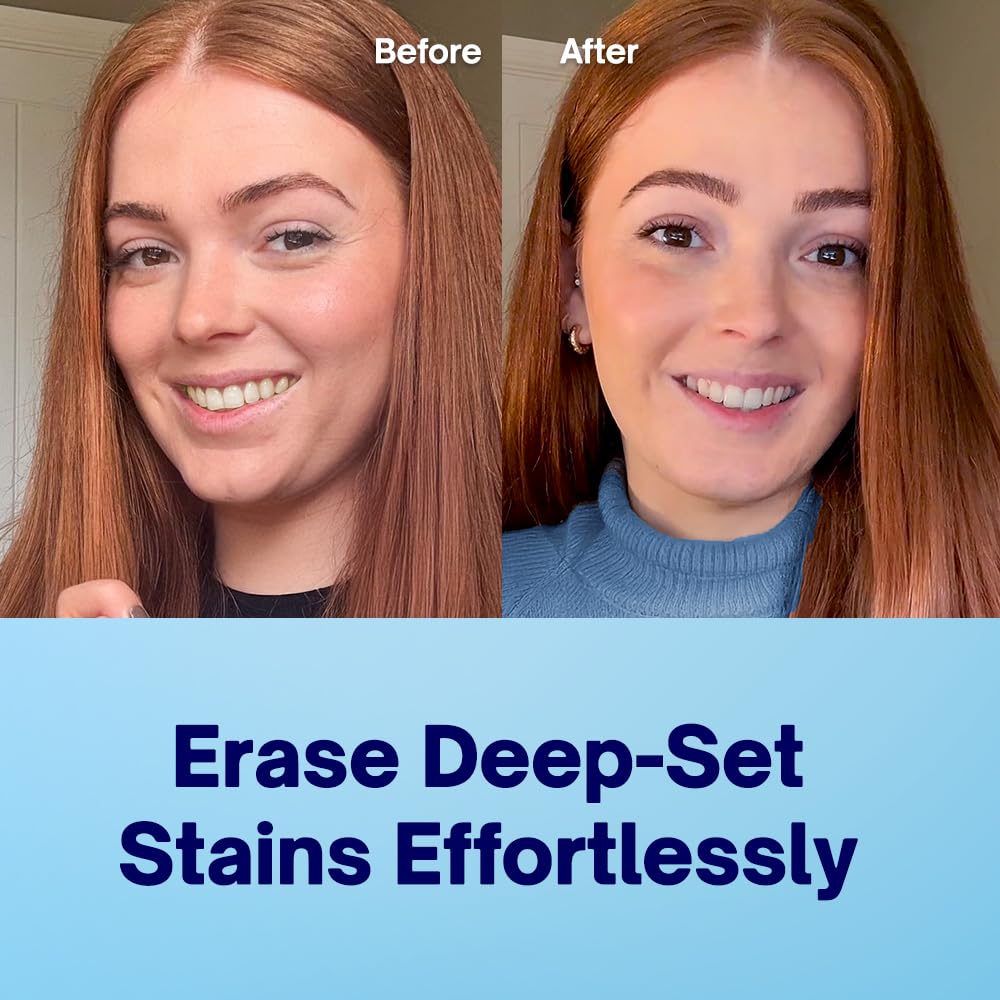 MySweetSmile Dermatest 5-star seal on whitening strips