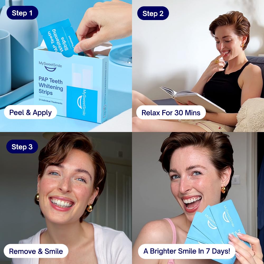 MySweetSmile free cheek retractor ensures even coverage during treatment