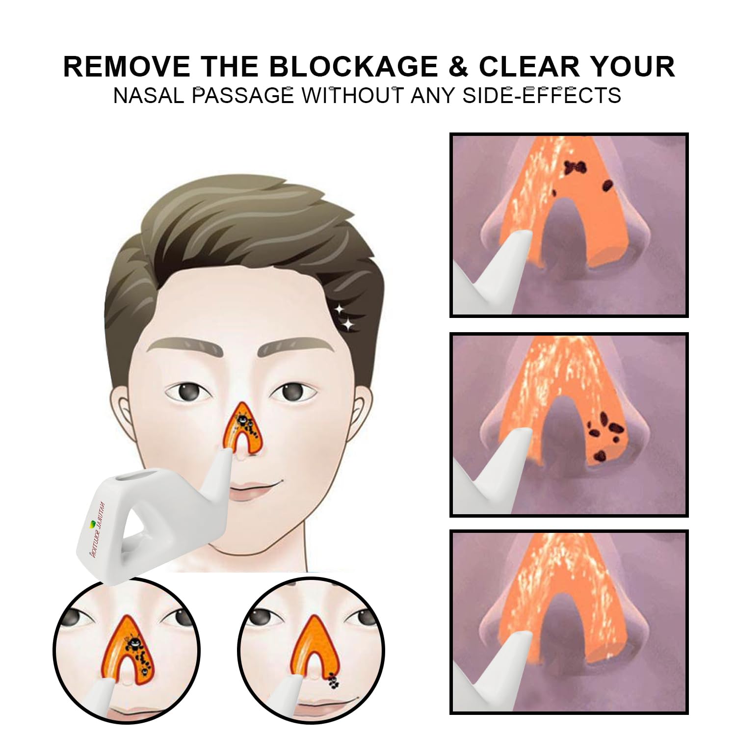 Natural Solution neti pot ready-for-use image conveys simple nasal rinse routine.
