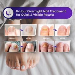 Natural Vine Easy Application Patches for simple nightly routine