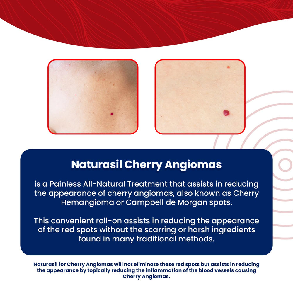 Naturasil Cherry Angiomas roller applying product on skin during routine care.