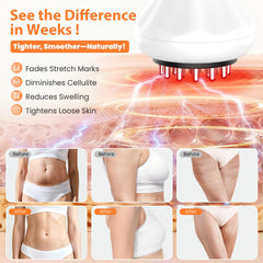 NENRENT rechargeable wireless design for cordless at-home therapy