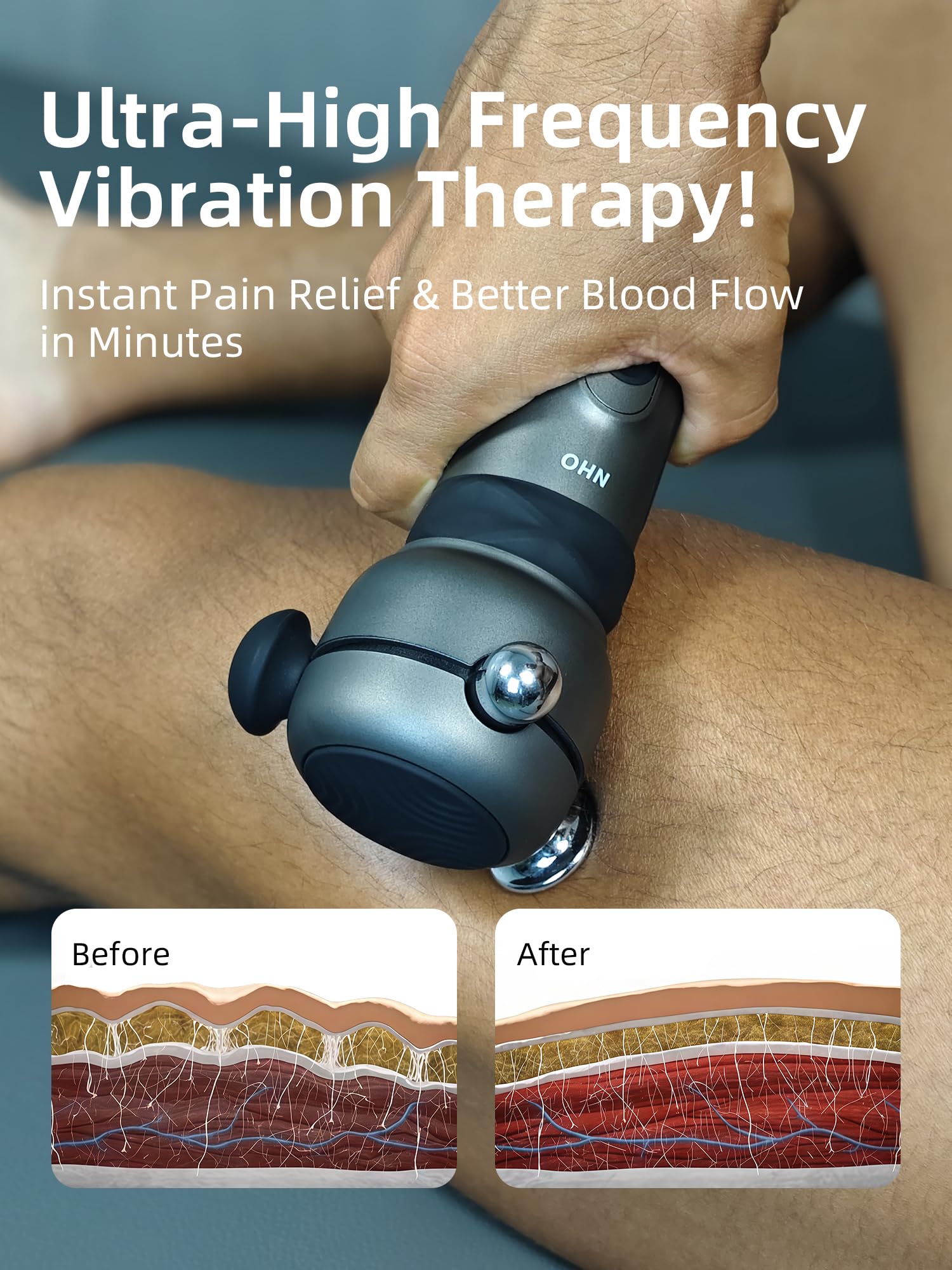 NHO massage gun foot plantar relief for improved comfort.