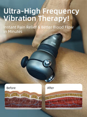 NHO massage gun foot plantar relief for improved comfort.