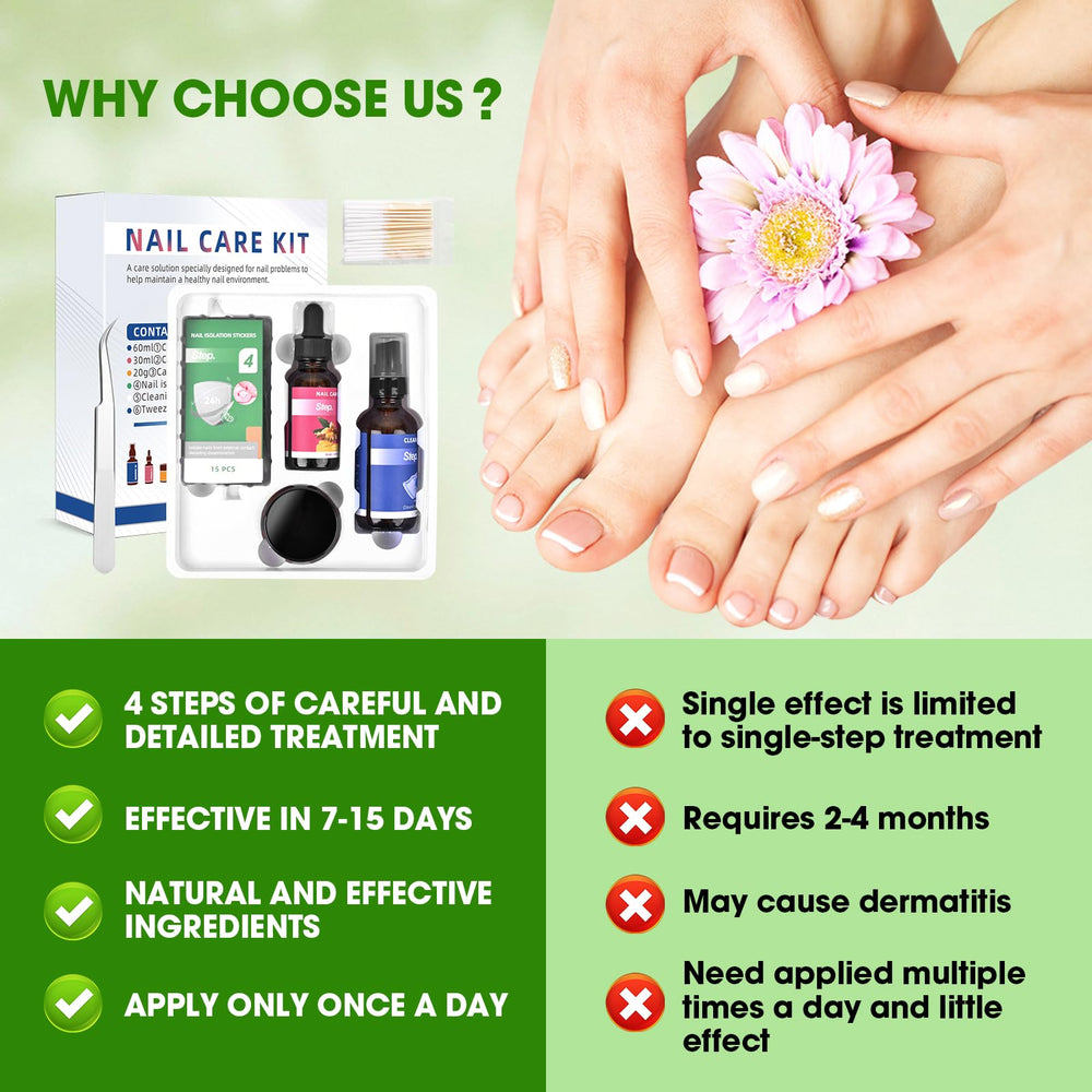 Nodfens nail swabs for hygienic cleansing around cuticles.