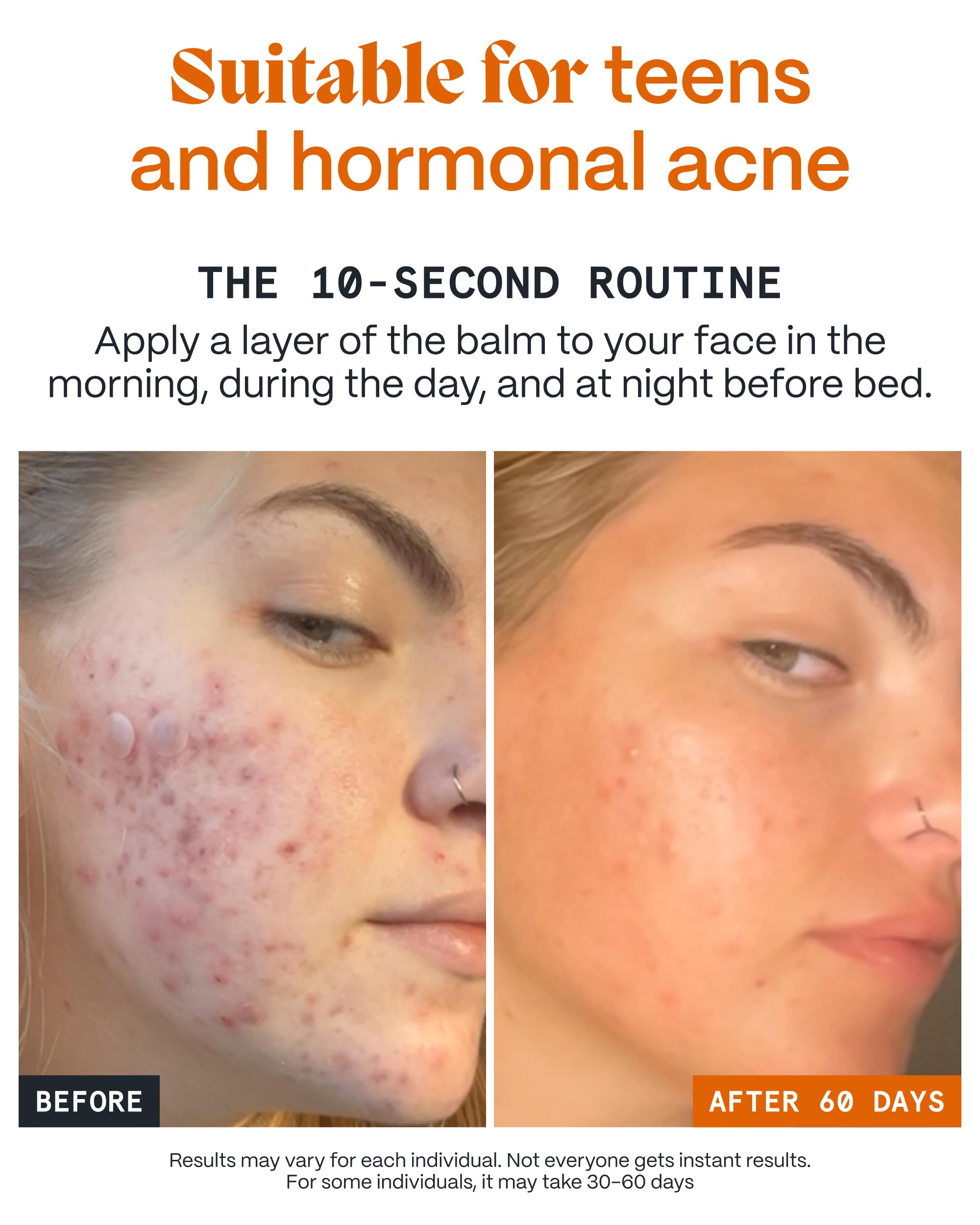 Small amount massaged into clean skin for targeted care