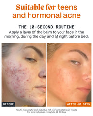 Small amount massaged into clean skin for targeted care