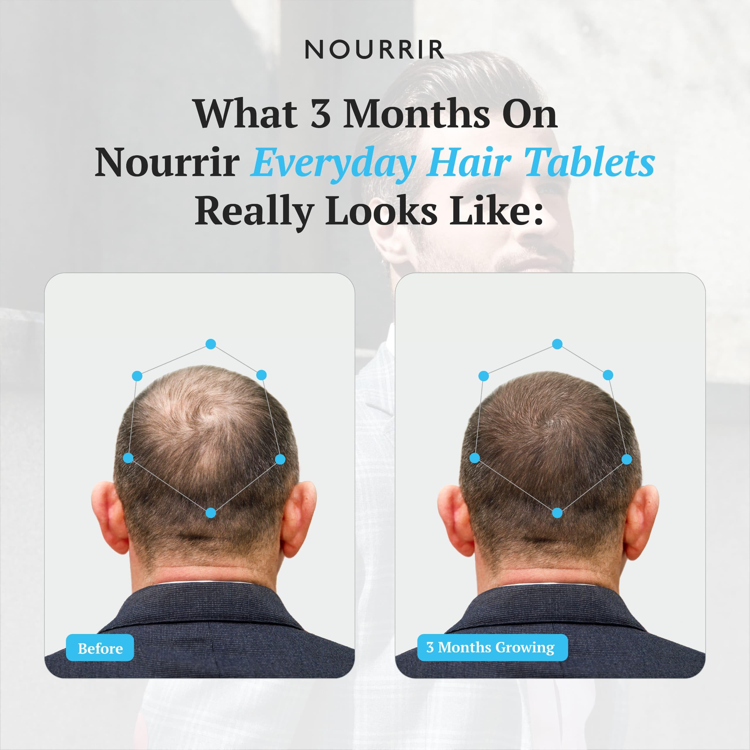 NOURRIR scalp nourishment visual highlighting hair vitality support