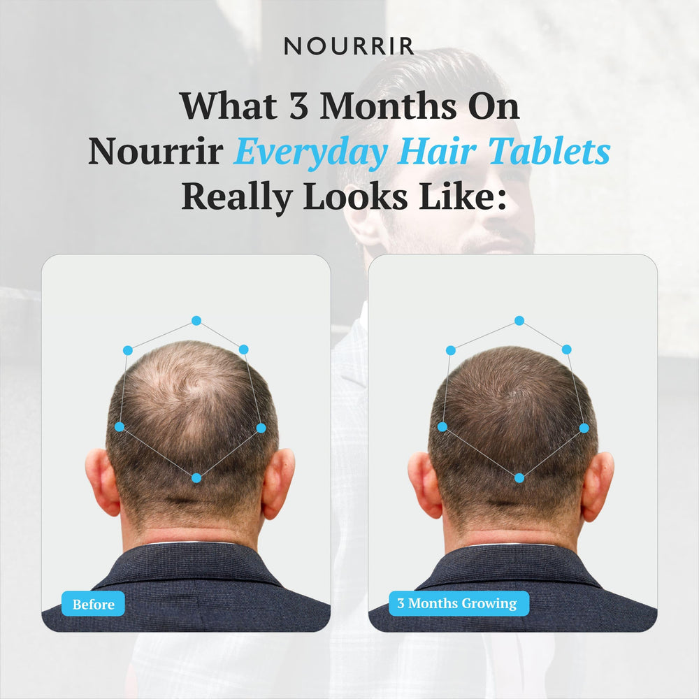 NOURRIR scalp nourishment visual highlighting hair vitality support