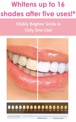 Novashine concentrated peroxide gel for quick stain lifting