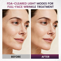 Novurial soft, skin-friendly materials ensure comfortable daily use