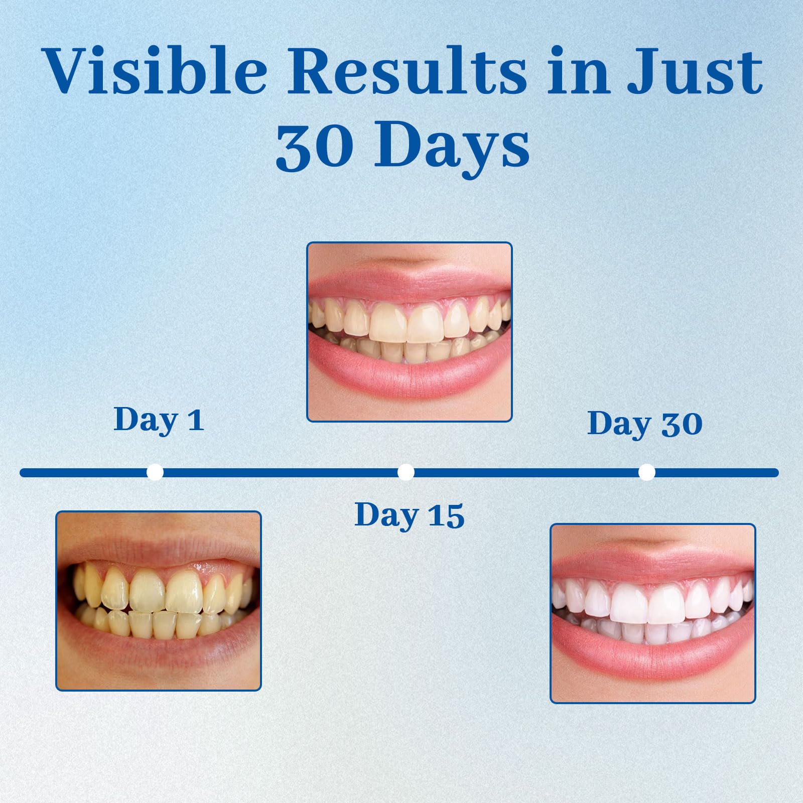 NUDENTA Odontic Repair enamel glow visual after remineralization.