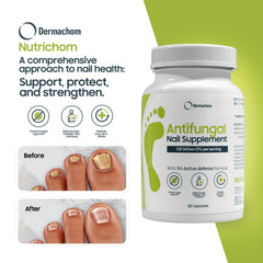Nutrichom biotin vitamin D and E may support nail resilience and growth.