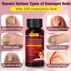 OETMOE base of cuticle application shown for proper coverage