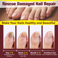 OETMOE hydrating repair liquid supporting healthier looking nails
