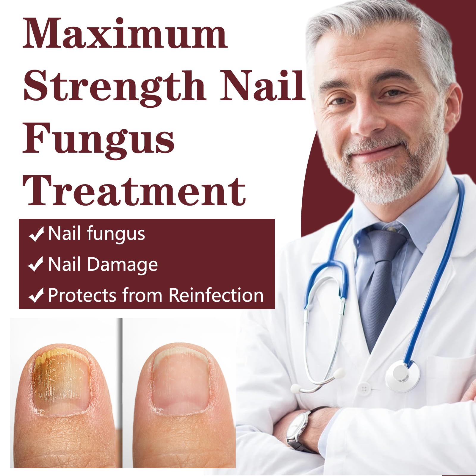 OETMOE thick nails care emphasis on strengthening brittle nails