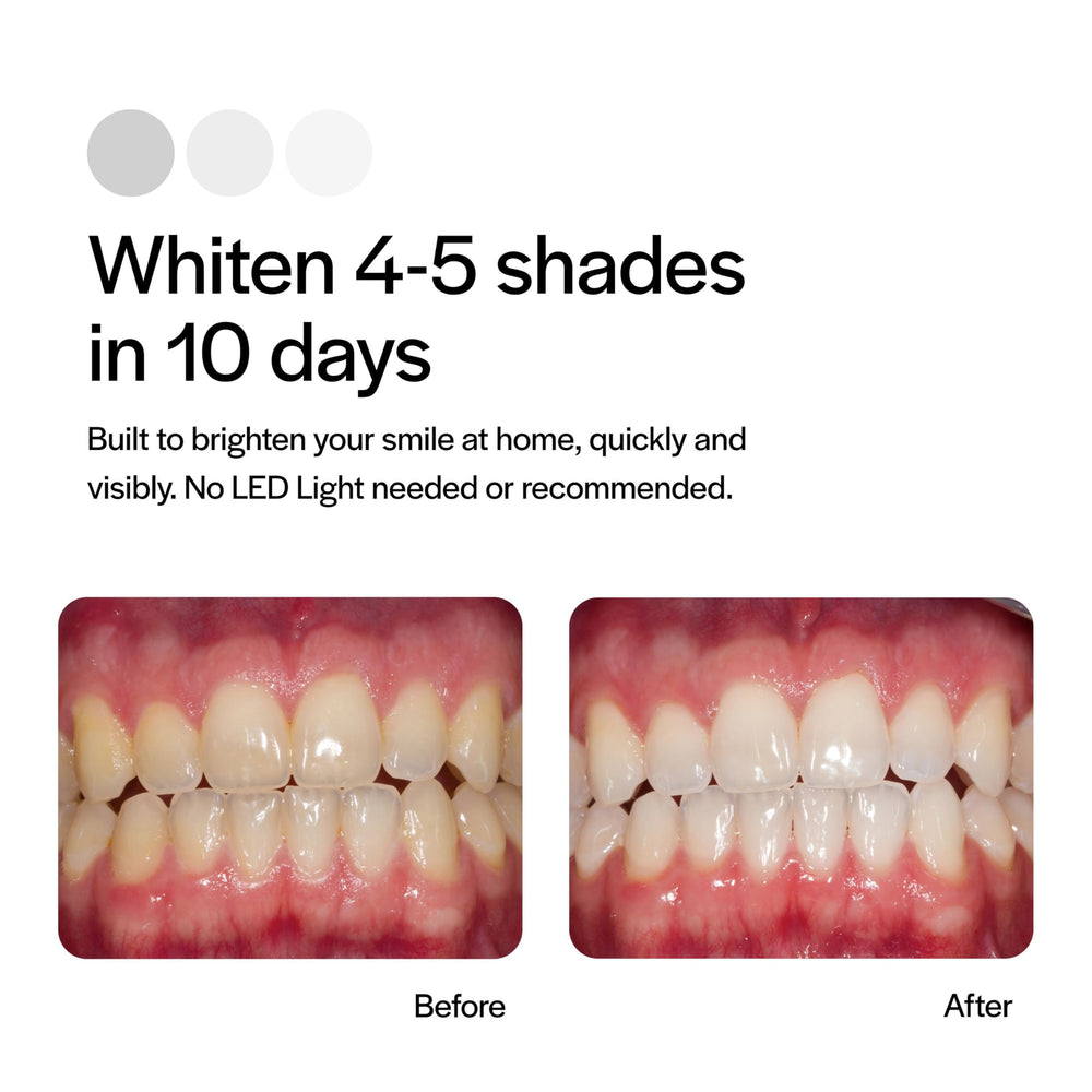 Opalescence Go uses potassium fluoride to help minimize sensitivity.