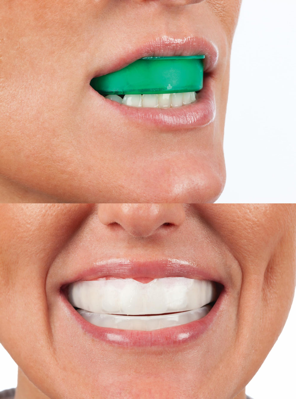 Opalescence Go delivers a cooling mint finish during whitening sessions.