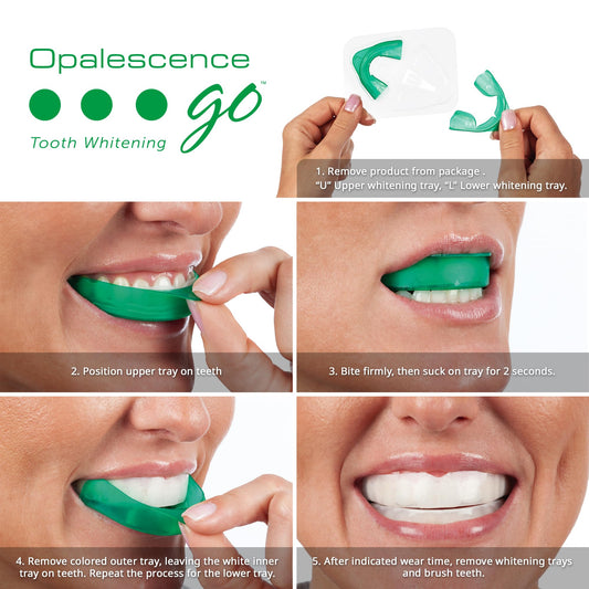 Opalescence Go trays top view showing prefilled gel for simple use.