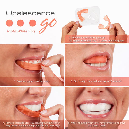 Opalescence Go UltraFit trays conform to your smile for comfortable whitening.