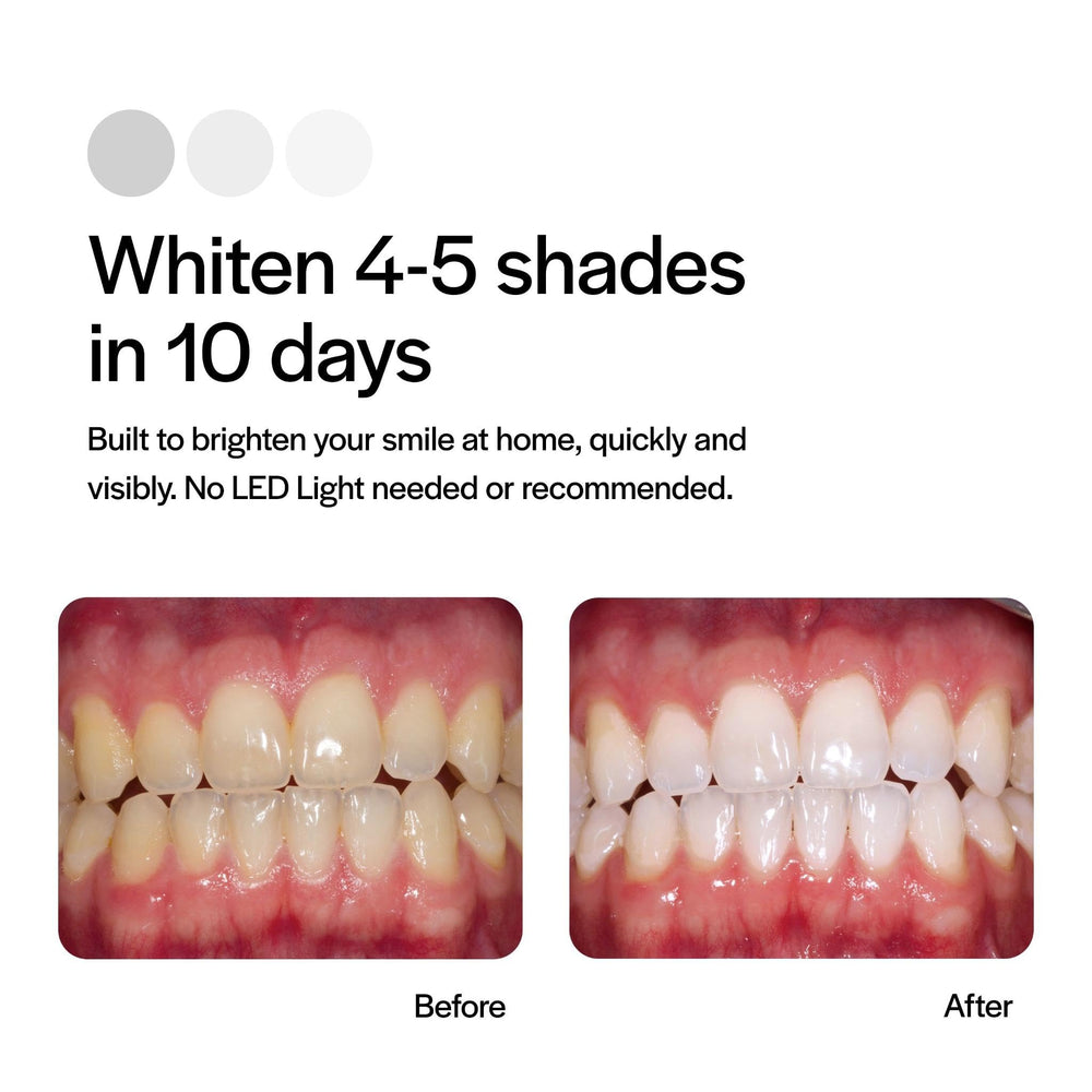 Opalescence Original toothpaste Cool Mint 1oz included for on-the-go whitening support.