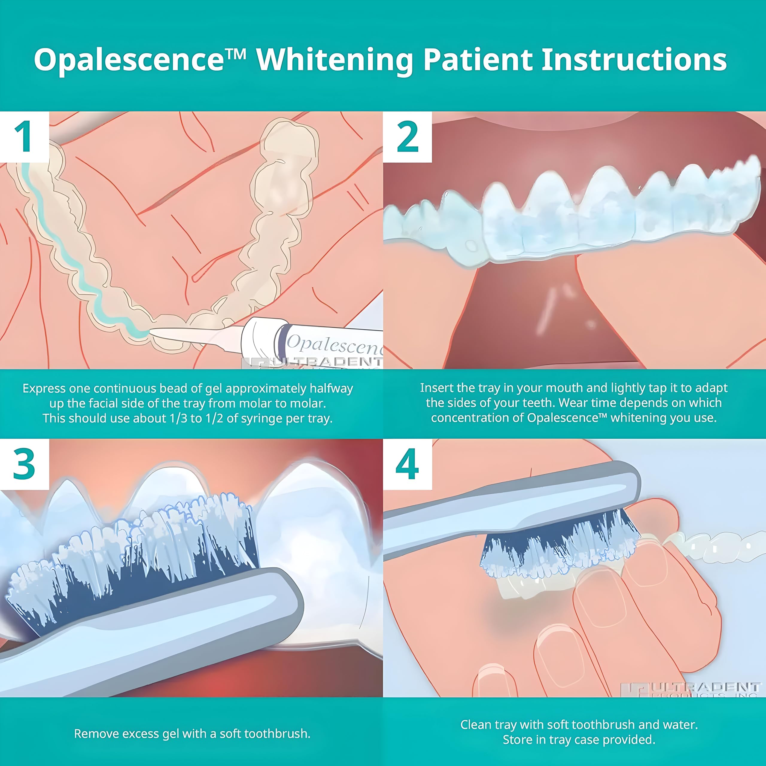 Syringe tips and gel displaying consistent viscosity for controlled whitening.