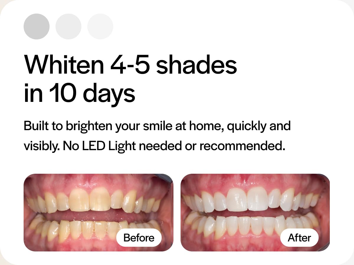 Opalescence tray compatibility with Invisalign and other dental trays.