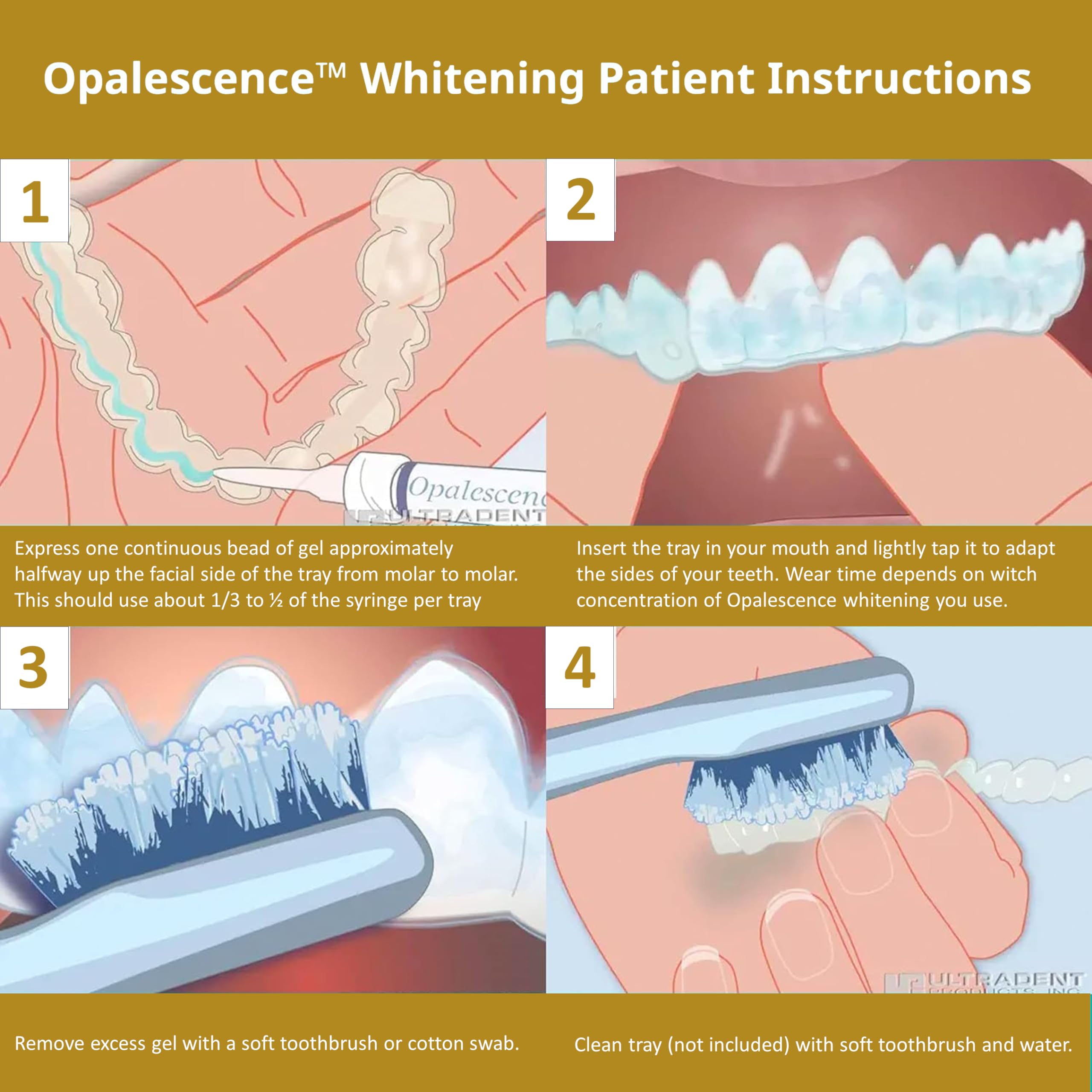 Opalescence USA-made by Ultradent ensures professional quality