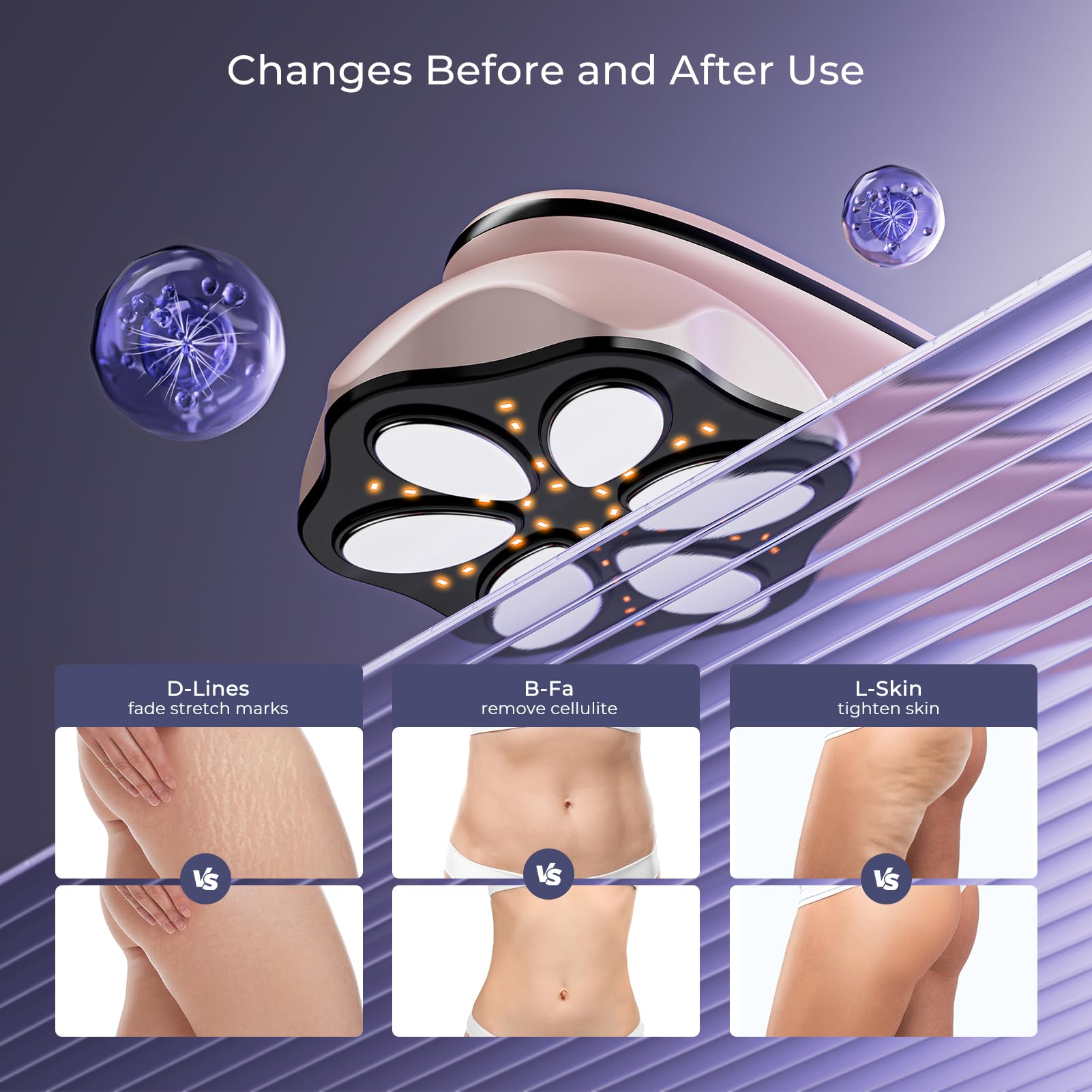 Oranmagic body massager on legs for even tone and firmer skin.