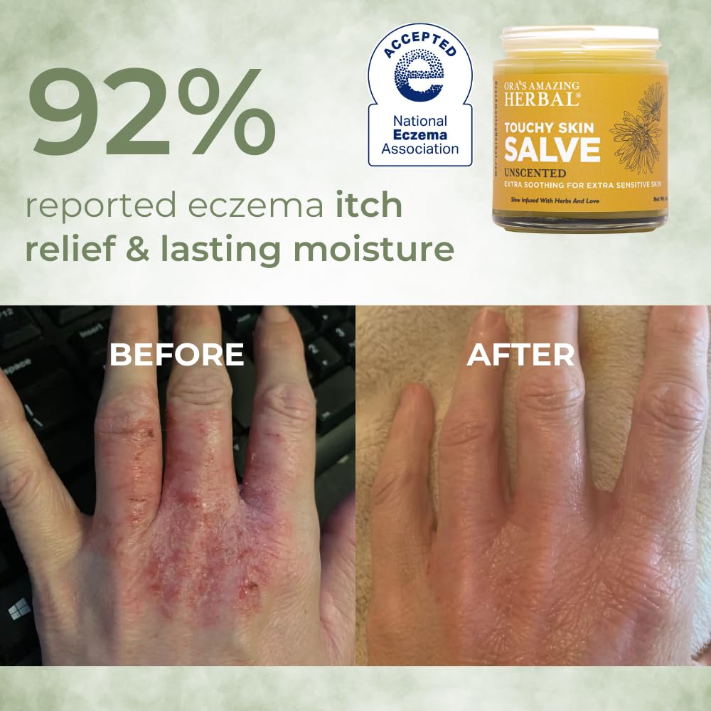 Ora's Amazing Herbal Touchy Skin Salve ingredients calendula-thyme closeup highlight soothing botanicals