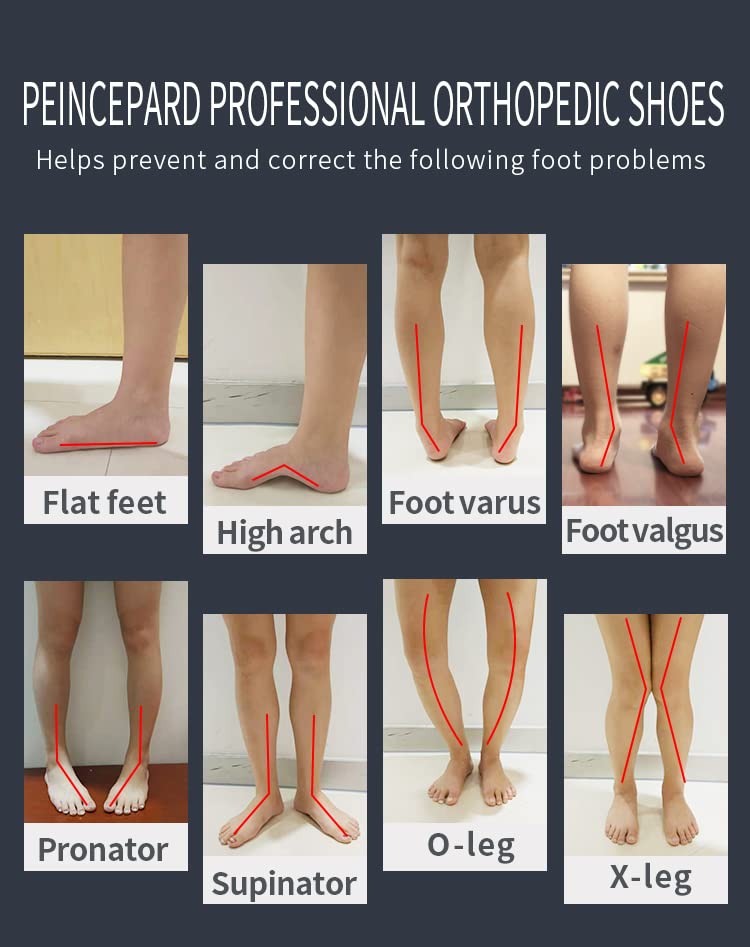 Orthopop kids orthopedic shoes blue ankle-brace stabilizes ankles for confident steps