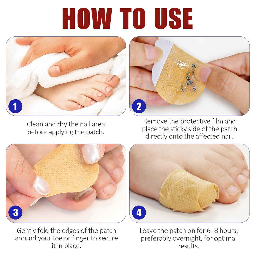 O.SECERT patches help reduce discoloration during nightly wear