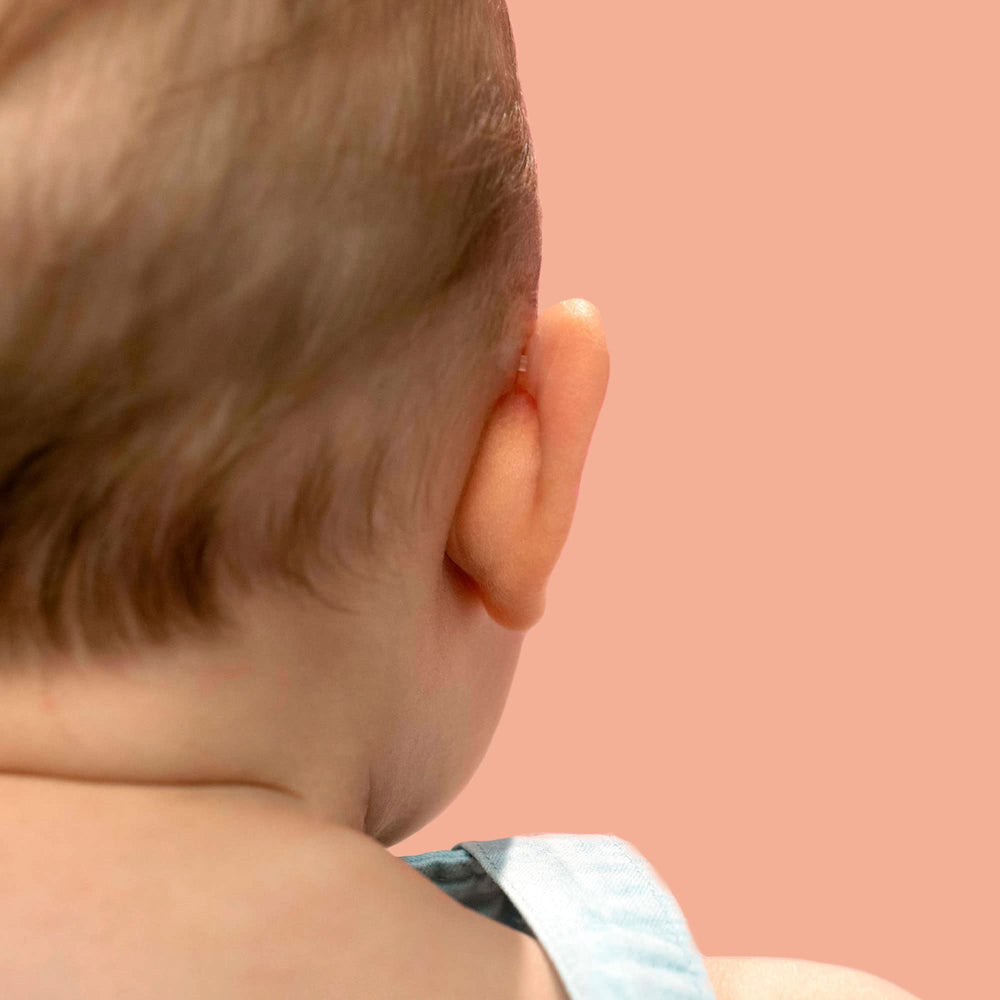 Otostick Baby on head during playtime illustrates comfortable wear for active babies.